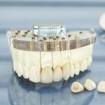 Ray